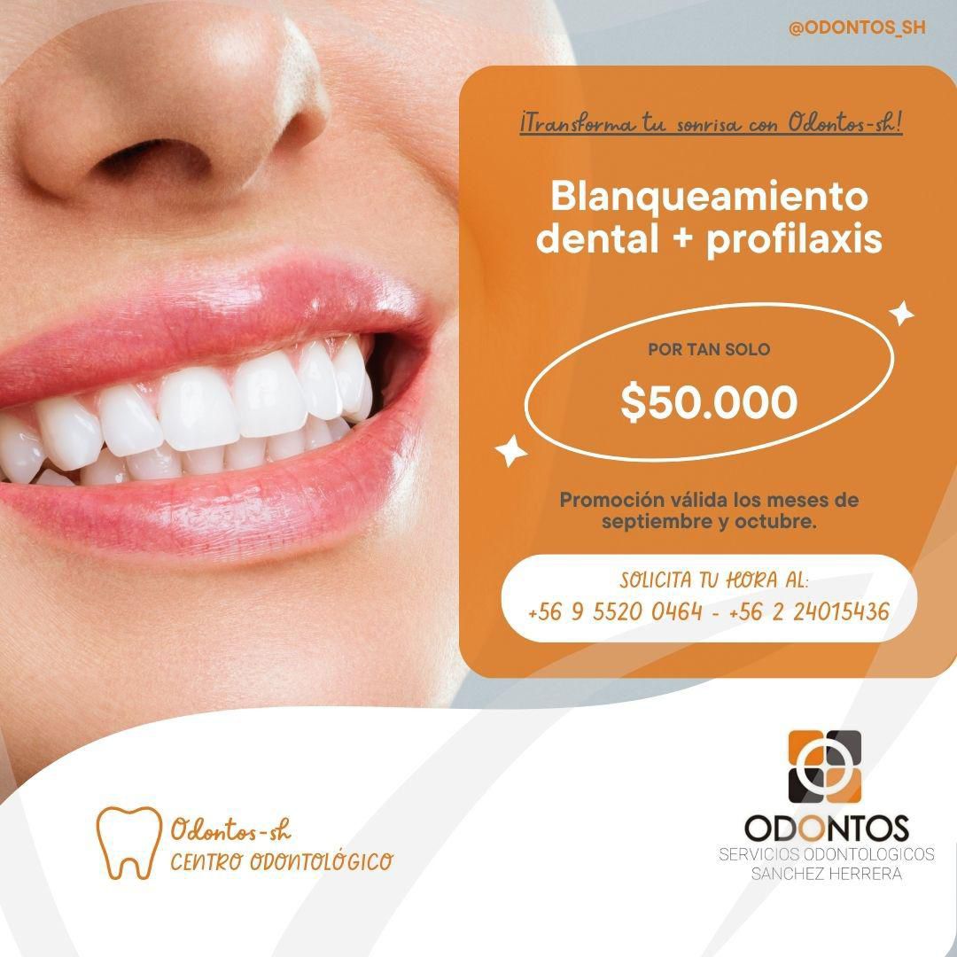 Promoción Blanqueamiento